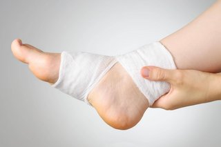 Ein Fuß einer Frau, der am Knöchel mit einer Bandage verbunden ist. 