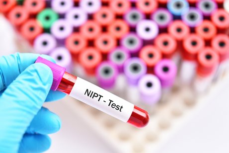 Eine Hand mit einem blauen Gummihandschuh h&auml;lt ein R&ouml;hrchen mit einer Blutprobe, es ist mit "NIPT-Test" beschriftet. Im Hintergrund mehr Blutproben.
